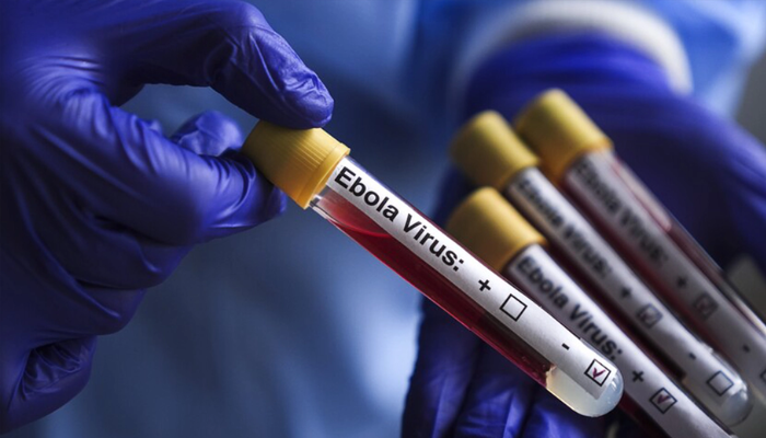 Ebola confirmed in Abuja, 44 under surveillance